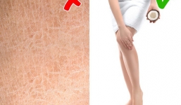 8 mẹo đơn giản giúp cơ thể sở hữu vẻ đẹp khỏe khoắn trong suốt mùa hè