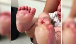 Mỹ: Tức giận vì bé 6 tháng tuổi quấy khóc, bảo mẫu nhẫn tâm nhúng 2 bàn chân bé vào chảo dầu sôi