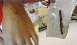 Giáo viên mầm non dùng bút đâm nhiều em nhỏ vì lý do này khiến phụ huynh bức xúc