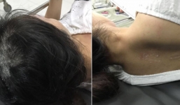 Nghi vấn mẹ chồng đổ keo 502 lên đầu con dâu, nhốt con trai trong nhà ép phải bỏ vợ