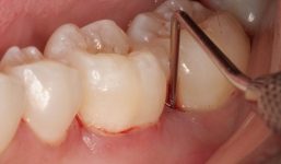 Dấu hiệu báo ung thư tuyến tụy đang 'lộng hành' trong cơ thể: Nắm lấy cơ hội sống cao nhất