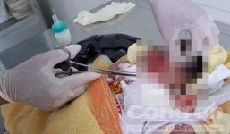 Cứu chữa kịp thời bé sơ sinh nghi bị mẹ ruột chôn sống