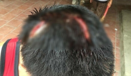 Người đàn ông bị 2 kẻ côn đồ bắt quỳ lạy, dùng hung khí đánh dã man