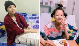 Vợ vừa mất, cha đau đớn nhìn con gái 16 tuổi xinh xắn phải cắt bỏ chân vì ung thư xương mà không đủ tiền chữa trị