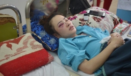 Thanh niên đánh cô gái nhập viện cấp cứu vì được ăn dĩa bánh xèo trước bị phạt 1,5 triệu