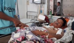 Đi làm ruộng giữa trưa, 2 nông dân bị sét đánh trúng