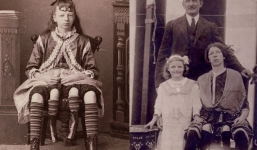 Cuộc đời người phụ nữ 4 chân: 13 tuổi làm ngôi sao gánh xiếc, sống đời sung túc với nghề triển lãm bản thân