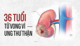 36 tuổi bị tử vong vì ung thư thận: Bác sĩ cảnh báo những thói quen bạn nên xem lại