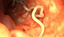 Loại kí sinh trùng có thể gây chết người này sẽ 'ẩn nấp' trong người bạn vì thường xuyên ăn những món 'khoái khẩu' này