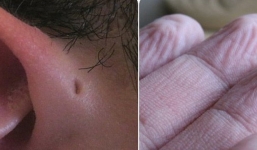 Ai cũng tưởng những bộ phận này vô dụng, nhưng hóa đây là vai trò của chúng