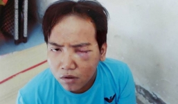 Đình chỉ điều tra vụ bảo vệ dân phố bị tâm thần cắt cổ bé trai 6 tuổi ở Sài Gòn