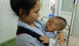 Bé 7 tháng tuổi bị hỏng 1 bên mắt vĩnh viễn vì mẹ nhỏ sữa chữa đỏ mắt