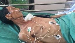 Sài Gòn: Người đàn ông 61 tuổi thoi thóp giữa đường, được bệnh viện điều xe chở về cứu mạng, phát thông báo tìm người thân