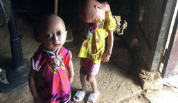 Tuyên Quang: 2 chị em gái mắc bệnh lạ khiến đầu, cổ bị nghẹo tựa 'người ngoài hành tinh' khiến ai nhìn cũng xót xa