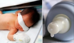 Chuyên gia Nhi khoa cảnh báo tuyệt đối không dùng sữa mẹ nhỏ mắt, bôi viêm da