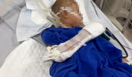 Thanh niên chém bé trai 9 tuổi lún hộp sọ rồi nhảy sông tự tử