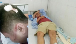 Bắt tạm giam tài xế ô tô khách đánh bất tỉnh người bố để con nôn ra xe
