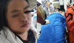 Trang điểm khi đang ngồi trên ô tô, cô gái bị bút kẻ mắt đâm xuyên mắt