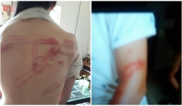 Vụ bố đẻ khóa trái cửa, dùng tuýp sắt đánh con: Cán bộ Văn hóa - Xã hội nói người bố đánh con nhưng vẫn thương con