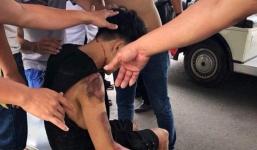 Xe điện mất lái tông vào nhóm du khách ở Bà Nà Hill, 6 người bị thương