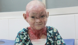 Cô gái bị lở loét khắp người đem tiền chữa bệnh đi xây cầu cho người nghèo đã nhận được hơn 200 triệu đồng