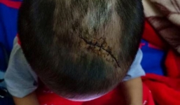 Bé trai 3 tuổi nghi bị chính mẹ ruột và cha dượng đánh đập tàn nhẫn