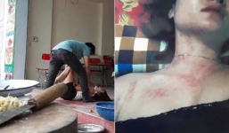 Phát hiện chồng ngoại tình, người phụ nữ đau đớn tột cùng khi còn bị chồng hành hung, mẹ chồng đuổi ra khỏi nhà cùng con gái gần 3 tuổi