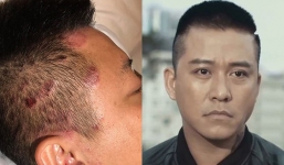 Tuấn Hưng công khai căn bệnh khiến anh buồn bã, suy sụp