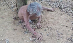 Cụ bà cởi trần bị chồng xích vào gốc cây ngoài vườn không bị tâm thần