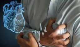 Thầy giáo đang coi thi THPT ở Cà Mau đột quỵ tử vong