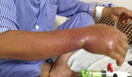 Cắt cỏ cá tại bờ ruộng, 5 ngày sau người đàn ông suýt mất mạng vì lý do không ngờ