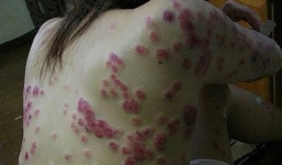 Dấu hiệu của căn bệnh xã hội cực kỳ nguy hiểm nhưng bị lãng quên