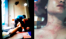 Tình tiết bất ngờ vụ vợ lên FB tố bị bạo hành: Người chồng khẳng định tất cả chỉ là chiêu trò của vợ