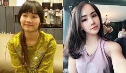 Từng bị bạn bè cầm chổi ném vì xấu xí, cô gái Hà Nội hở hàm ếch lột xác, đổi đời sau phẫu thuật thẩm mỹ