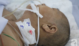 Bán nhà cho con cưới vợ, bà mẹ nghèo bị tai nạn giao thông không tiền chữa trị phải cắt cụt chân hiện đang lâm nguy