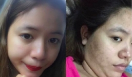 Tăng 10kg sau sinh không giảm, cơ thể sồ sề mặt chi chít vết thâm, bà mẹ trẻ tuyên bố: 'Gái một con trông mòn con mắt' là giả dối!