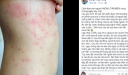 Xôn xao thông tin du khách bị ngứa ngáy, nổi mẩn khi xuống tắm tại biển Đà Nẵng