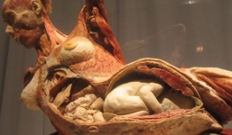 Có người chồng nào nhẫn tâm hiến thi thể của vợ và đứa con chưa sinh của mình để phục vụ khoa học?