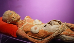 Nguyên Cục phó Bảo vệ trẻ em: “Không thể nhựa hóa xác em bé, bào thai… để trưng bày'