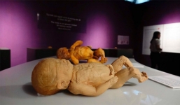 Bộ VH-TT-DL nói gì về triển lãm nội tạng và cơ thể người thật?