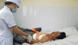 Phát hiện kẻ trộm, chủ nhà tri hô bị xịt hơi cay và chém đứt gân tay