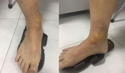 Đi massage về, quý ông ở Hà Nội phải trả giá đắt