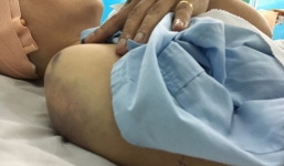 Lời kể kinh hoàng của nạn nhân trong vụ nổ súng khiến 2 cô gái bị thương