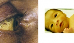 2 dấu hiệu cảnh báo có thể bạn đang mắc phải căn bệnh mang tên 'kẻ giết người thầm lặng'