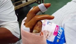 Vết thương khủng khiếp của 2 người phụ nữ bị gã cuồng yêu nã súng