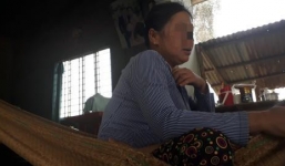 Dùng dao lam rạch mặt bồ của chồng vẫn phải thừa nhận đẹp hơn mình