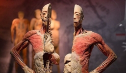 Cục Mỹ Thuật, Nhiếp ảnh và Triển lãm báo cáo vụ Triển lãm xác người gây tranh cãi