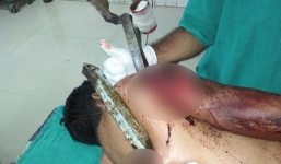 Sống sót thần kỳ sau khi bị thanh sắt dài 5m đâm xuyên người