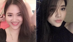 Bị chồng cũ chê răng 'thò thụt mất trật tự', ly hôn xong mẹ trẻ bỏ 40 triệu đi niềng răng, vô tình lột xác đến ngỡ ngàng