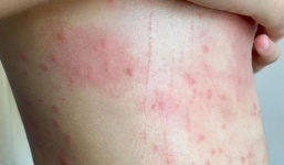 Đà Nẵng: Đã có kết quả phân tích nước biển, cảnh báo người dân hạn chế xuống tắm